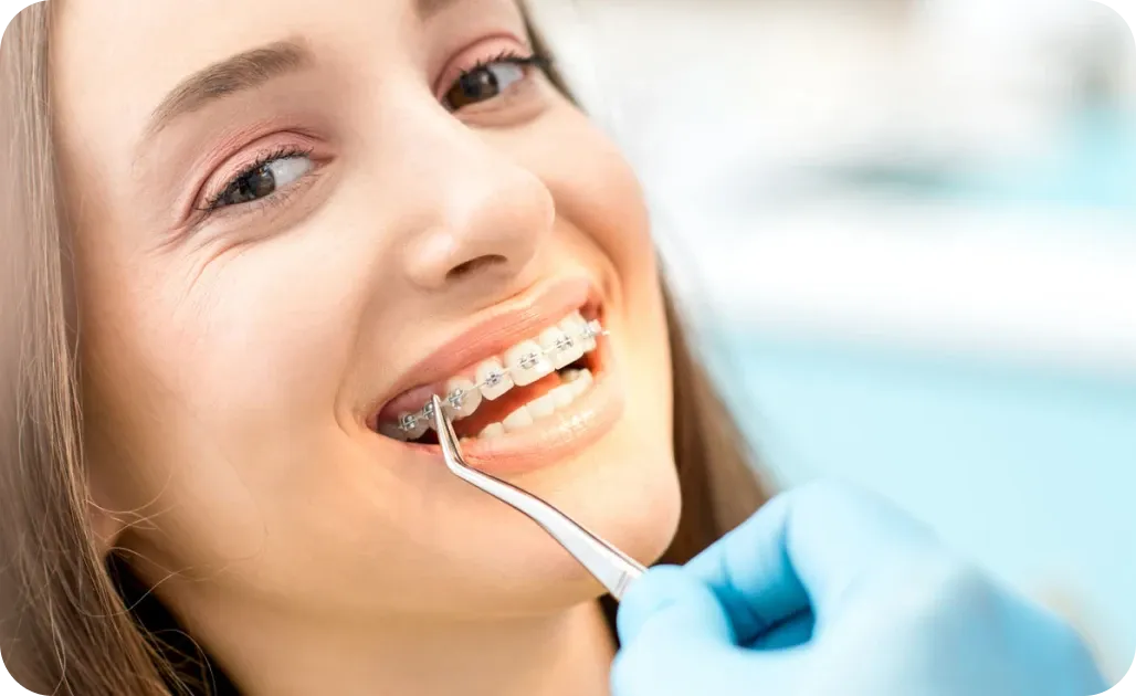 Orthodontiste Tarbes 65000 bagues