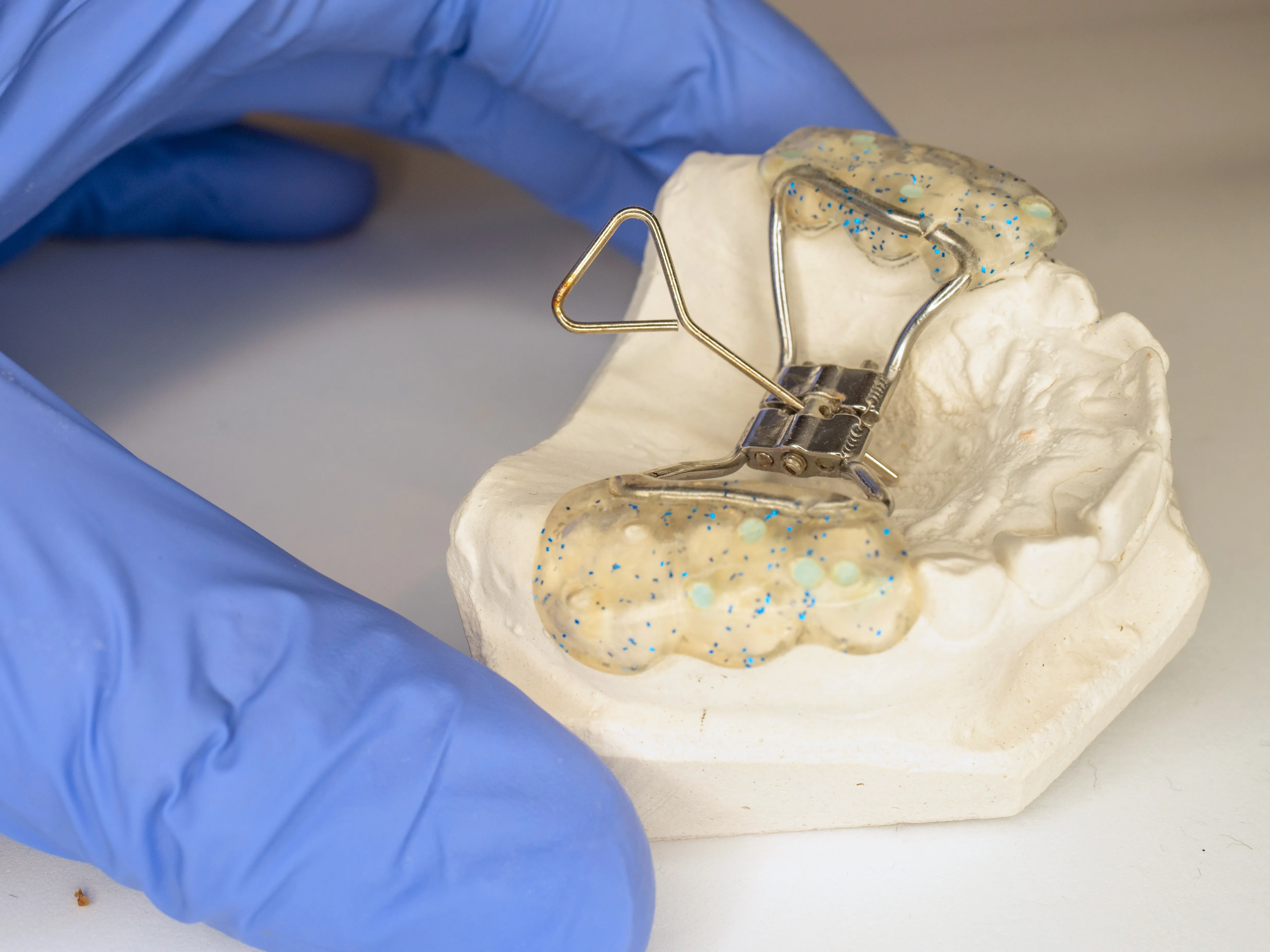 Orthodontiste enfants Tarbes 65000 Disjoncteur