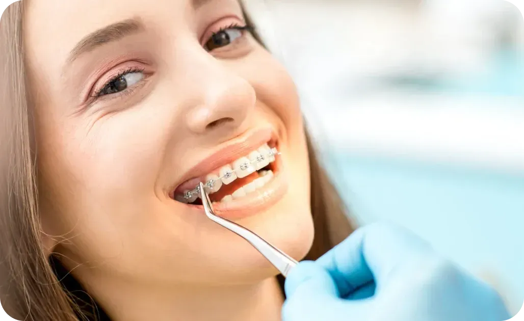 Orthodontiste Tarbes 65000 bagues