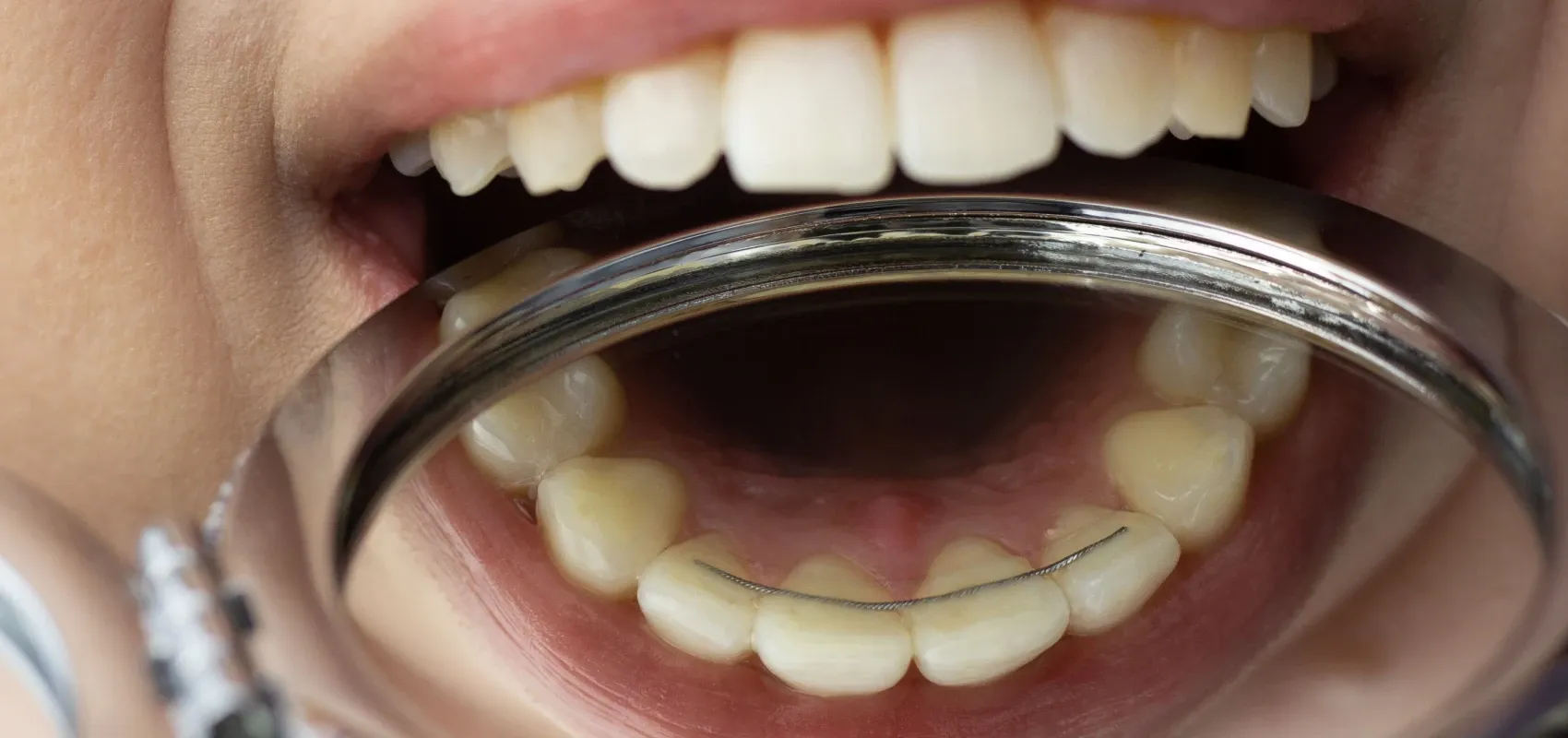 Orthodontiste Bagn&egrave;res-de-Bigorre