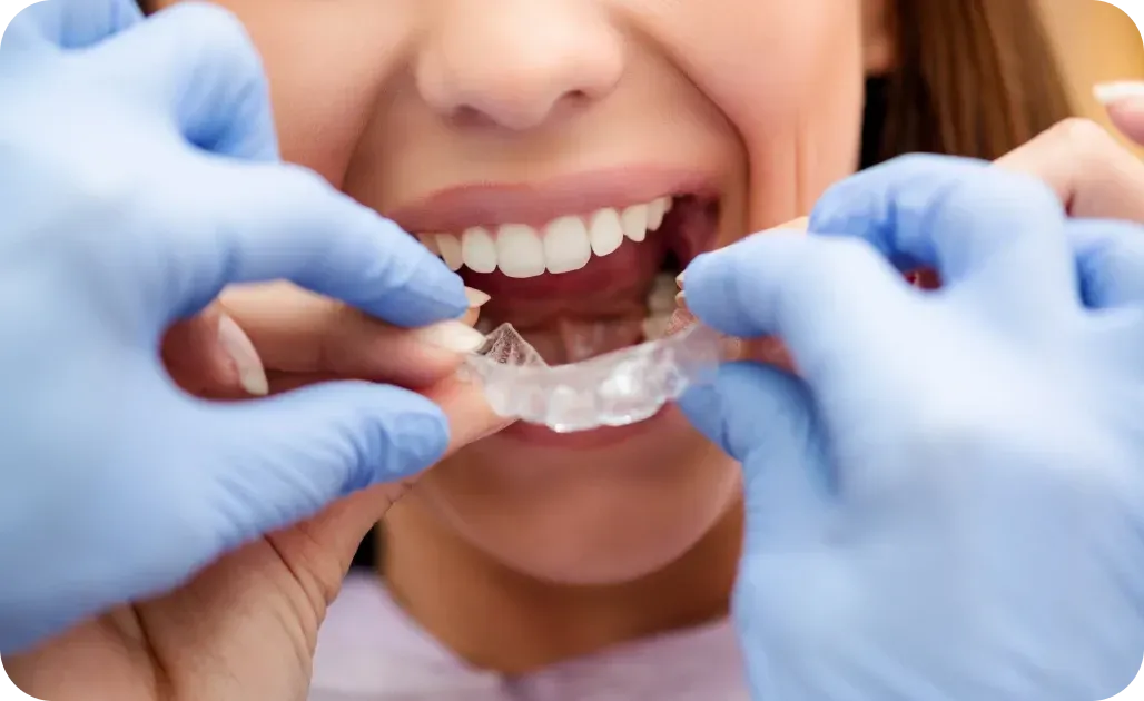 Laboratoire de prothèse, Orthodontiste Tarbes 65000
