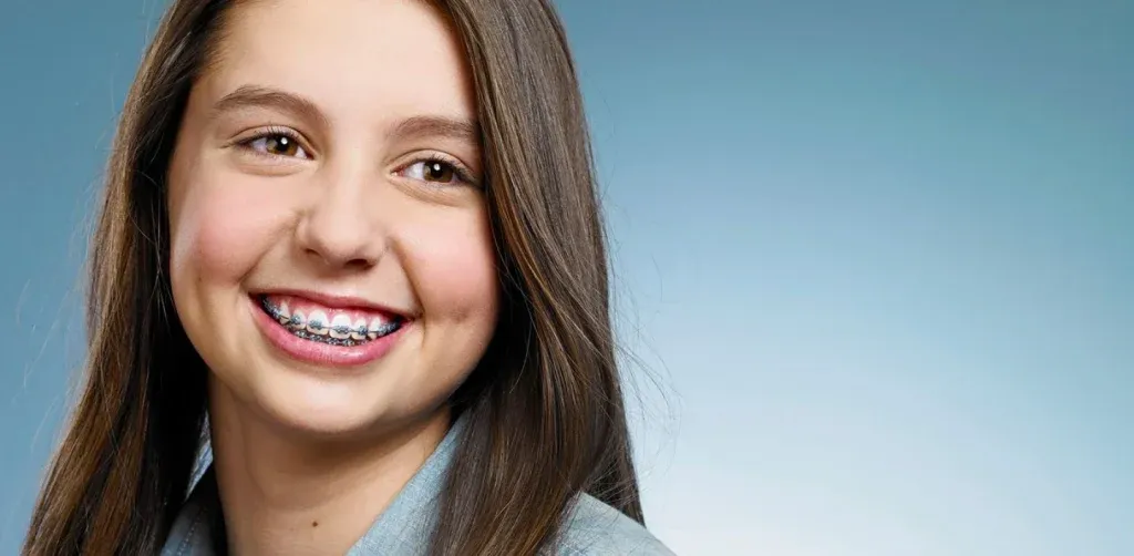 Orthodontiste Tarbes 65000 bagues