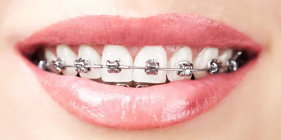 Orthodontiste à Tarbes 65000, Dr Marta Rajewska